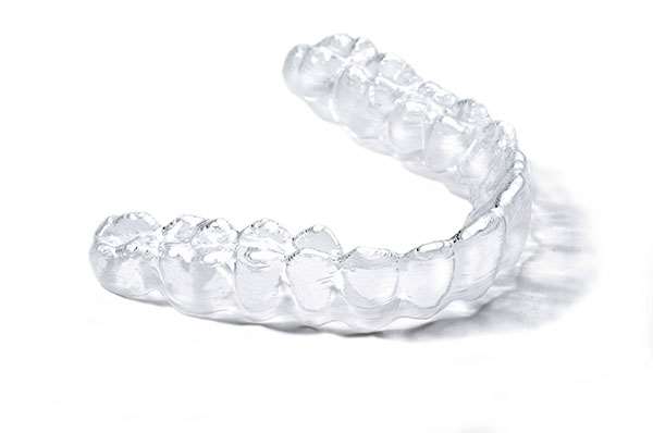 how-your-custom-invisalign-aligners-are-designed